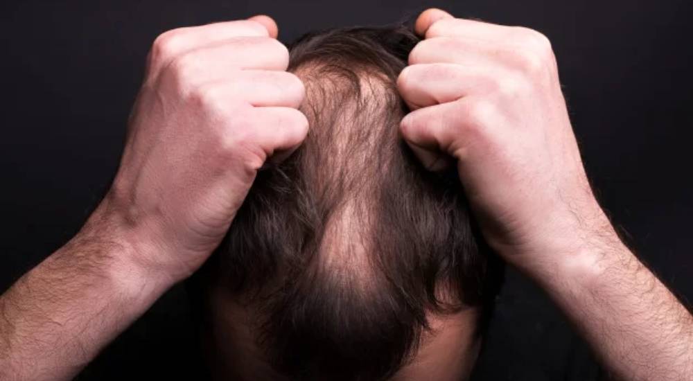 Hair Problem
